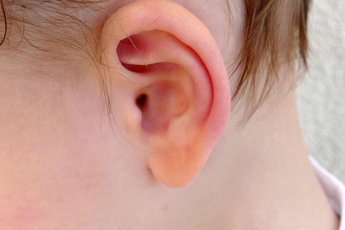 Mal d'orecchio Bambini